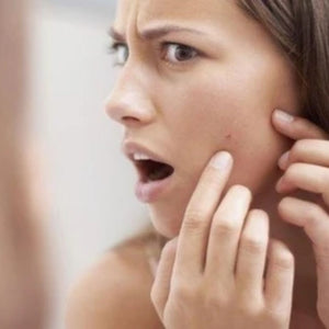 Why You Should Never Pick Your Pimples
