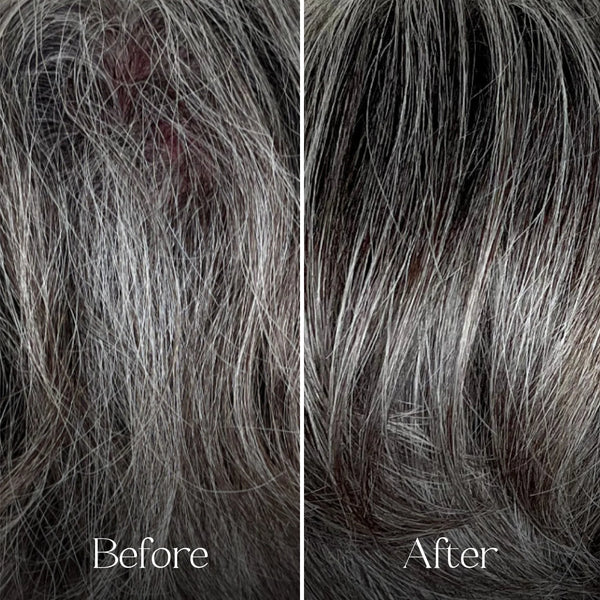 Before and after comparison of gray hair treatment on a person's head.