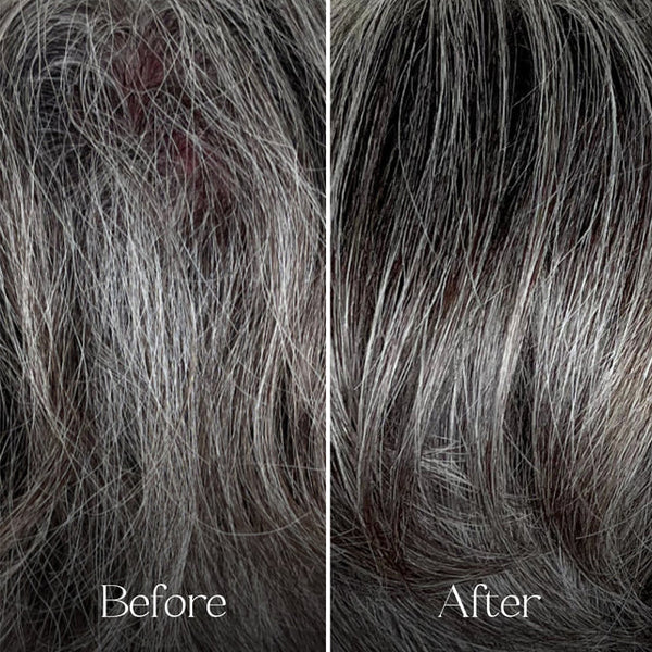 Before and after comparison of gray hair treatment on a person's head.