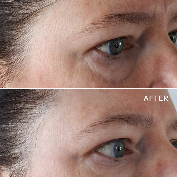 EyeHero™ Bio-Retinol Smoothing Eye Cream