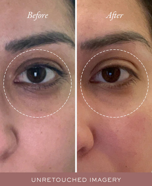 Golden Glow Eye Balm: Before and after comparison of a person's eye with a focus on skin texture.