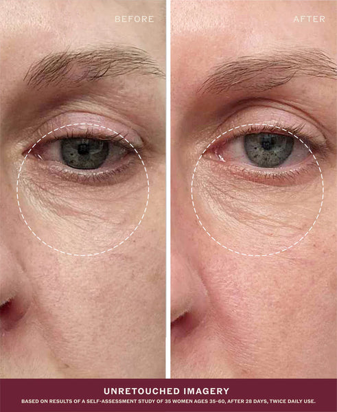 Golden Glow Eye Balm: Before and after comparison of eye area with no retouching applied.