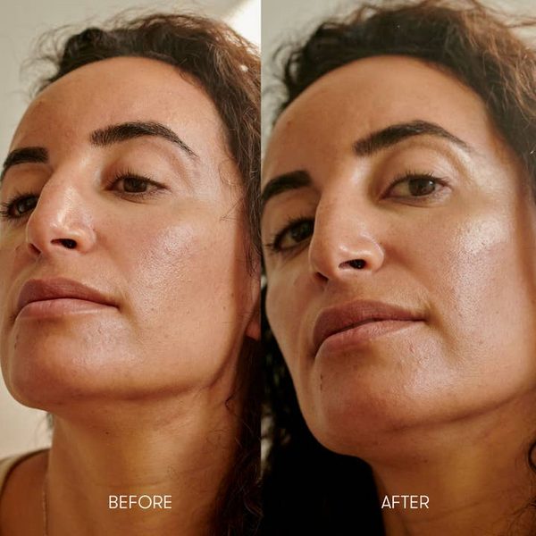 Before and after comparison of a woman's face with visible skin texture differences.