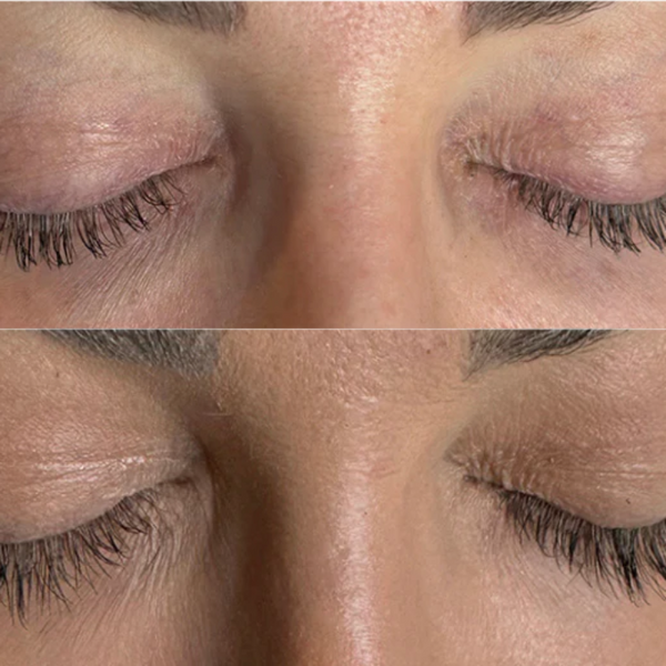 Before and after results using Plume Elite Lash Growth Serum