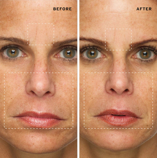 Before and after with use of Sahajan's Radiance Ritual skincare set
