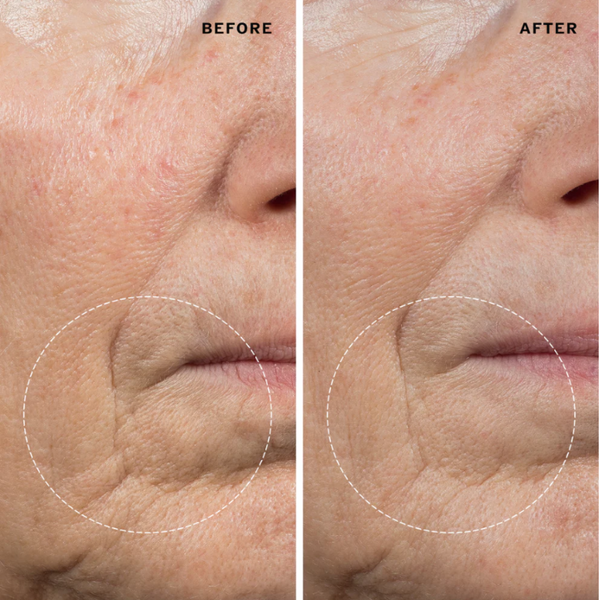 Before and After Sahajan Sacred Flower Face Oil