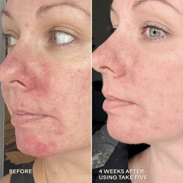 Take Five™ Hypochlorous Acid Balancing Body + Face Spray