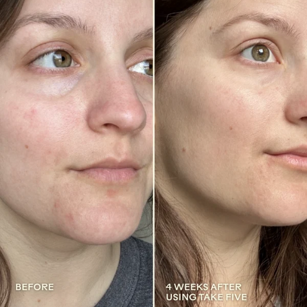 Take Five™ Hypochlorous Acid Balancing Body + Face Spray