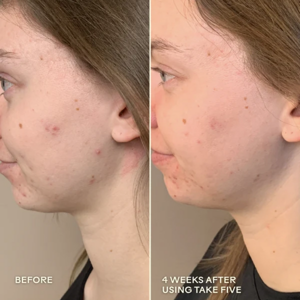 Take Five™ Hypochlorous Acid Balancing Body + Face Spray