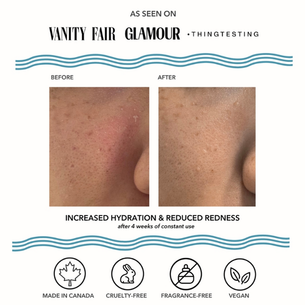Before & After using  Vintage Noon Vacation Skin after sun Overnight Mask & Moisturizer